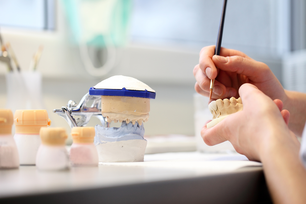 Die Vorteile von Zahnimplantaten